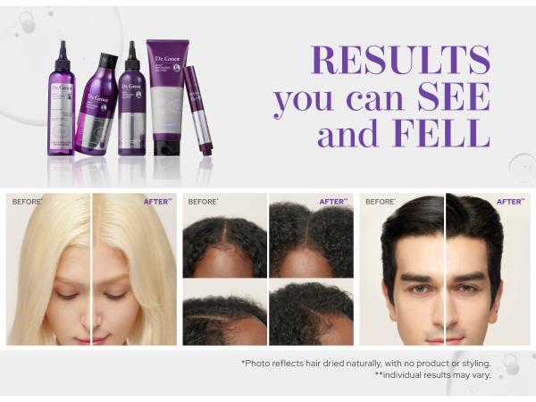 Dr. Groot Scalp Revitalizing Solution Scalp Exfoliating Detox Water - Gentle Exfoliation with AHA PHA LHA, Rosemary Oil, Menthol, Niacinamide for All Scalp Types