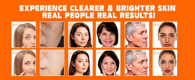 ISTON Ultra-Moisturizing Vitamin C Facial Serum 50 ml with Hyaluronic Acid, Niacinamide and Peptides Pure Vitamin C Facial Serum for the face, anti-aging, lightens dark spots, evens skin tone and eliminates fine lines and wrinkles.