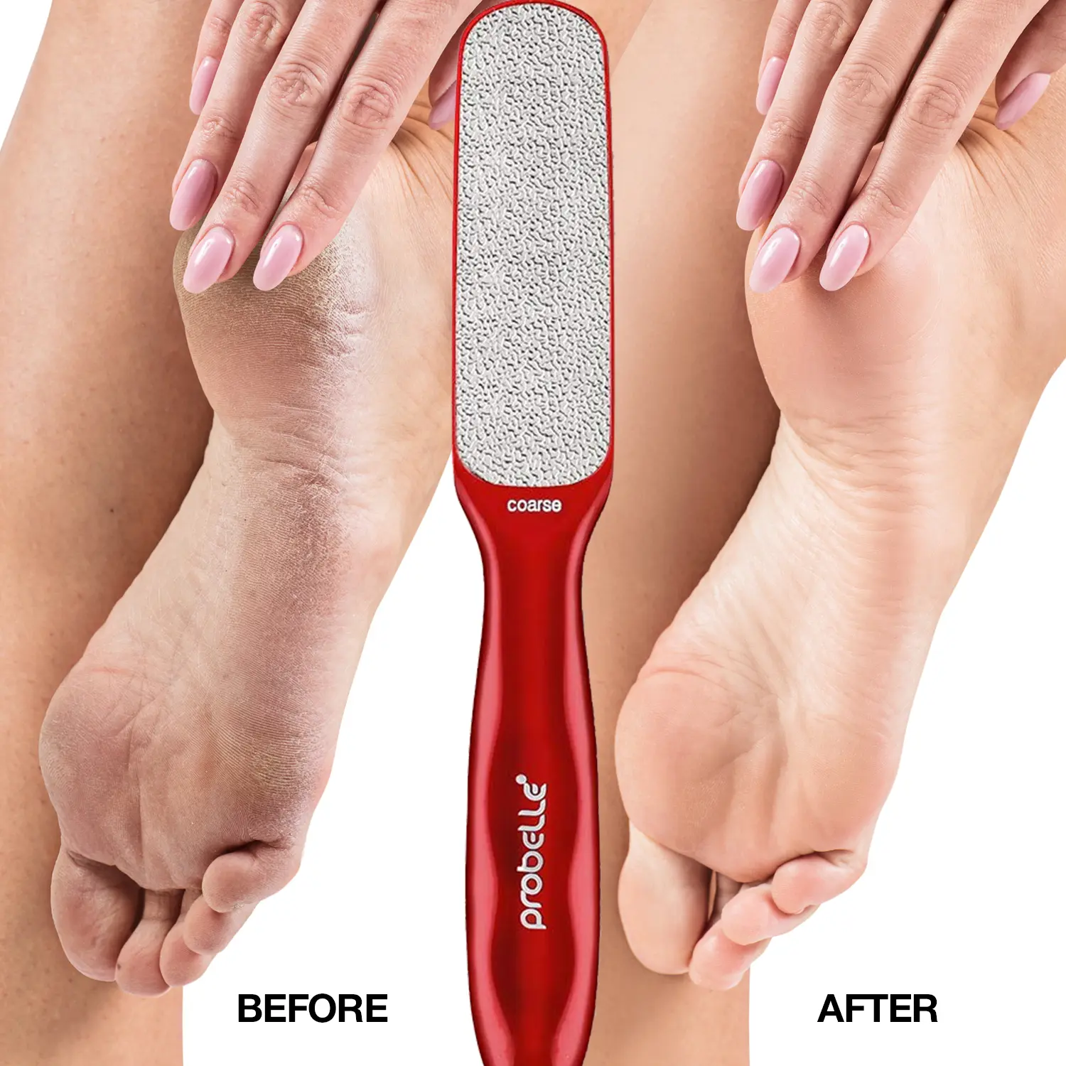 Probelle 2-Sided Multidirectional Nickel Base Metal File Foot Callus Remover - Smooth, Weighted Handle for Secure Grip, Nail Care Tool for Manicure & Pedicure, Instant Callus & Corn Reduction, Skin Softener