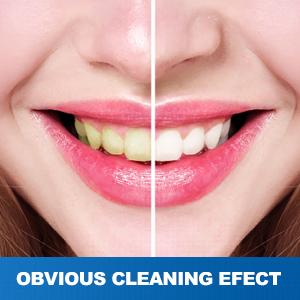 Foldable  Irrigator, Cordless Water Flosser with 4-nozzle 230ML Water Tank Travel  Irrigator, Ideal Teech Cleaning Device, Portable  Irrigator rechargeable waterfloss dental flosser cordless  oral care kit detachable