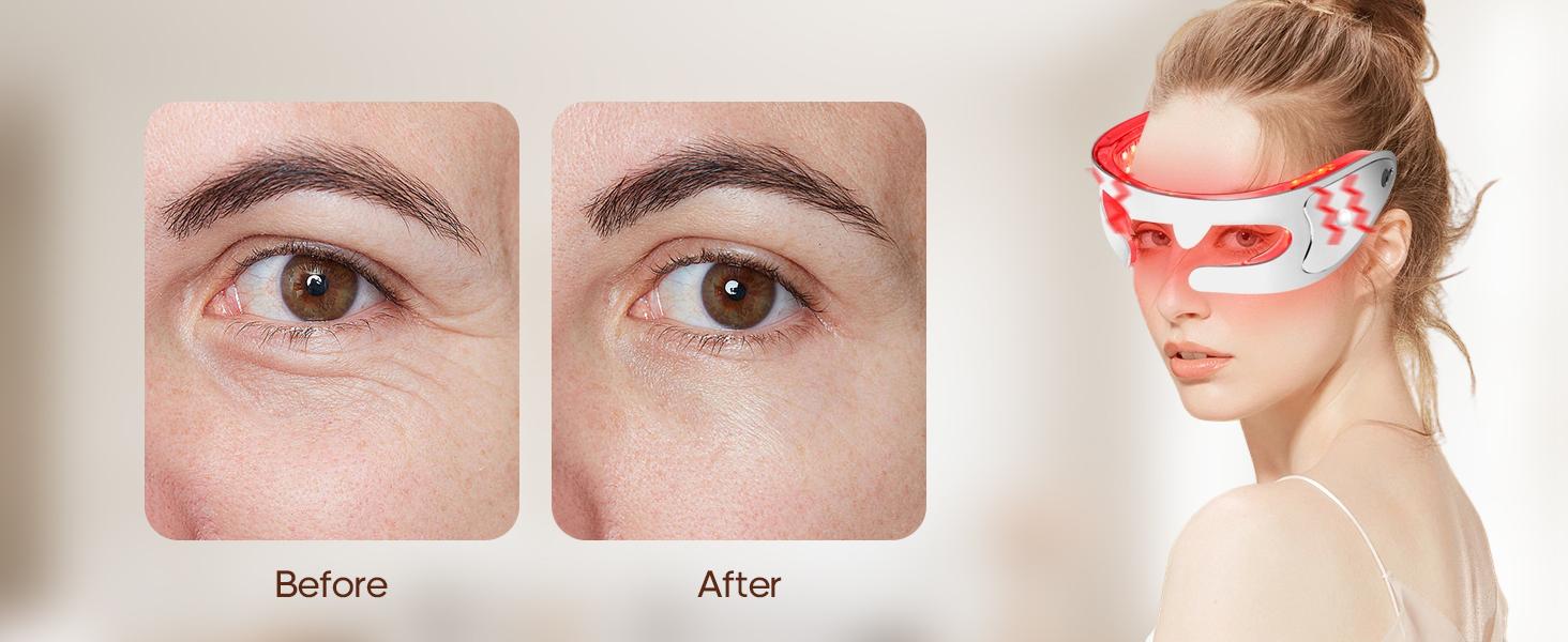 LED Red Light Therapy Eye Device,LED Light Therapy with Soothing Vibration, Adjustable Strap & Rechargeable LED Eye Mask,3 Modes Red Light Eye Mask for Skincare,Under-Eye Treatment & Rejuvenation,for Anti-Aging, Dark Circles and Wrinkles