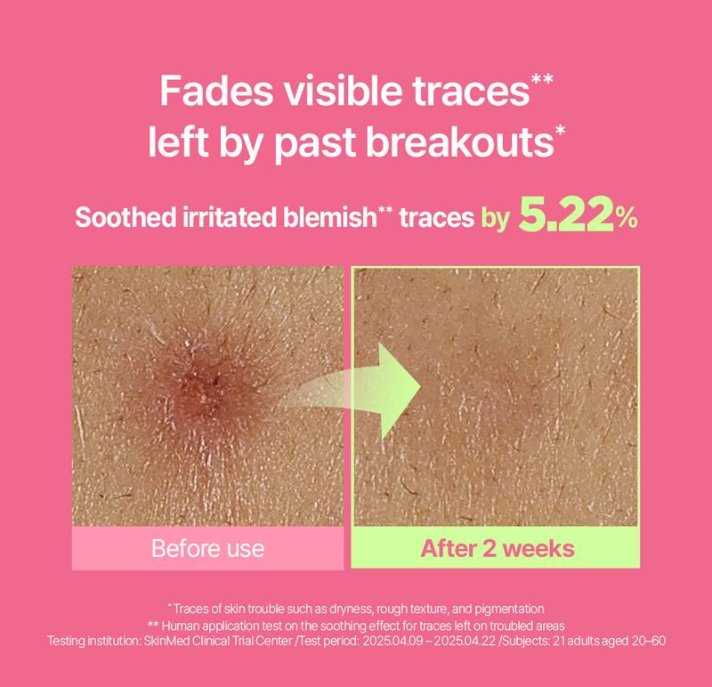 [BeginS by JUNGSAEMMOOL] Pink Guava Glutathione Blemish Serum | Korean Facial Serum | 10% Niacinamide, Vitamin C-rich Jeju Guava for Dark Spot Care and Radiant Glass Skin (1.01 Fl Oz)