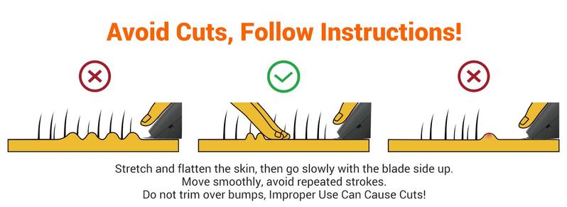 Manspot LADYSPOT4 in 1 Electric Bodyandwomen Hair Shaver - Groin Hair Trimmer, Ball Trimmer for Men with Replaceable Ceramic Blade Heads, USB Recharge, 90 Minutes Shaving,Waterproof, Safe & Gentle Trimming, Quick Gifts