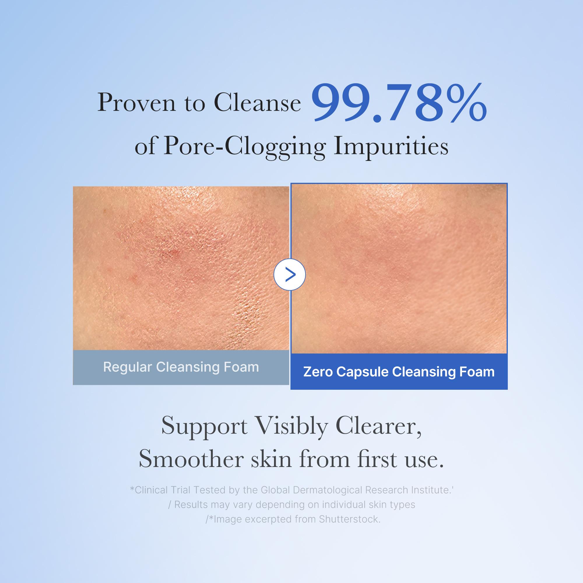 [medicube] Zero Pore Clear Blue Capsule Facial Cleanser for Skin Texture, Blackhead & Pore Care | AHA, BHA & PHA for Double Cleansing, Daily Gentle Face Wash, Korean Skincare | 120g / 4.23 oz