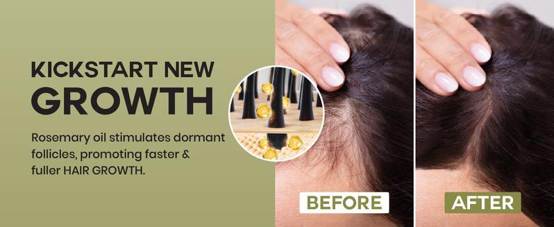 Lebanta Batana Oil For Hair Growth (BOGO)- 100% Pure, Raw & Natural Blend With Organic Castor, Pumpkin Seed, Coconut and Rosemary Oil - Thicker, Stronger Hair For Men & Women Scalp (2 Pack) Haircare Serum Lebanta Batana Oil For Hair Growth (BOGO)- 100% Pure, Raw & Natural Blend With Organic Castor, Pumpkin Seed, Coconut and Rosemary Oil - Thicker, Stronger Hair For Men & Women Scalp (2 Pack) Haircare Serum