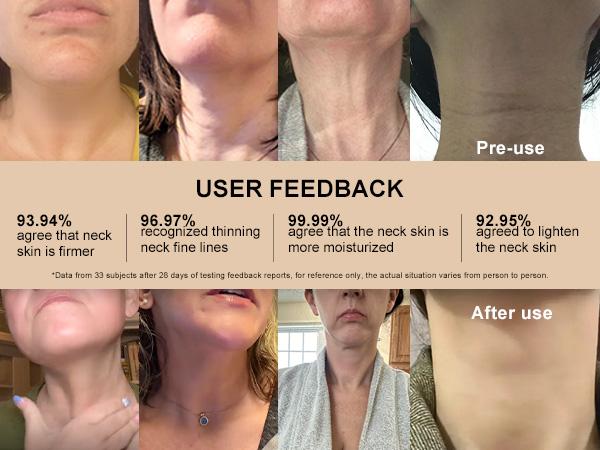 YCZ Neck Firming Cream, Upgraded Formula | Deep Moisturizing for Crepey Skin on Neck, Arms, Thighs & More | Cruelty-Free Skincare