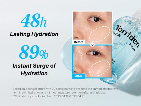 [Torriden Official] DIVE IN Low-Molecular Hyaluronic Acid Serum 50ml / 1.69 fl. oz. | Lightweight Hydrating Facial Serum for Glowing Skin