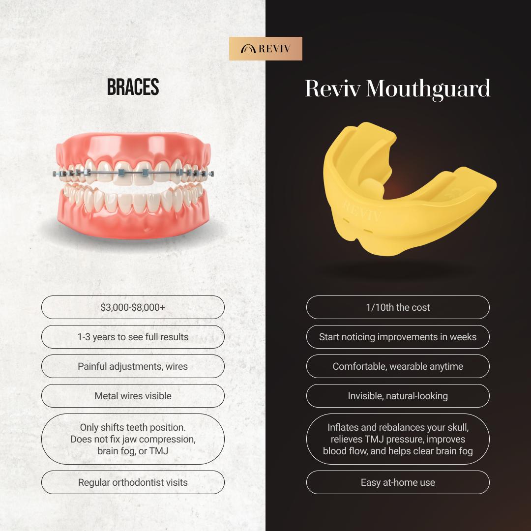 Reviv Mouthguard R2 for Teeth Grinding, TMJ Relief & Better Sleep - Soft Silicone with Supportive Fit for Daily Use Reviv Mouthguard R2 for Teeth Grinding, TMJ Relief & Better Sleep - Soft Silicone with Supportive Fit for Daily Use