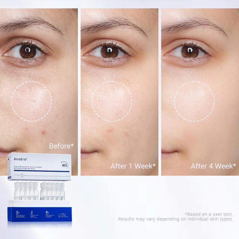 AnaEra Pro-Grade Age Reset Set | Choose Your Hero Serum: 5% HA Ampoule OR PDRN+Copper Peptide | Prevent Skin Aging | BFS Sterile Technology | Target Wrinkles, Loss of Firmness & Dryness