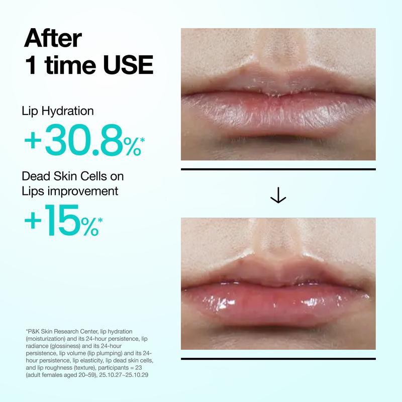 [Anua Official] PDRN Lip Serum 10ml l All day Hydrating Lip Serum, Salmon PDRN Collagen, Plumping, Long-Lasting Moisturizing, Dry Lips Treatment