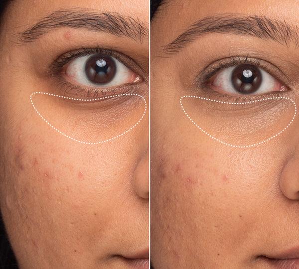 INNBEAUTY PROJECT Bright & Tight Dark Circle Firming Eye Cream with Vitamin C & Peptides