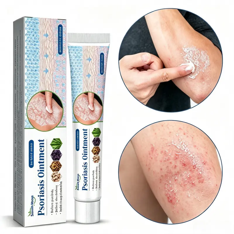 South Moon Herbal Psoriasis Ointment - Cooling, Gentle Non-Greasy Moisturizing Balm for Fast Itch Relief on Dry, Flaky, Rough Skin, Targeted Spot Care for Elbows, Knees, Daily External Use for Seasonal Sensitive Skin