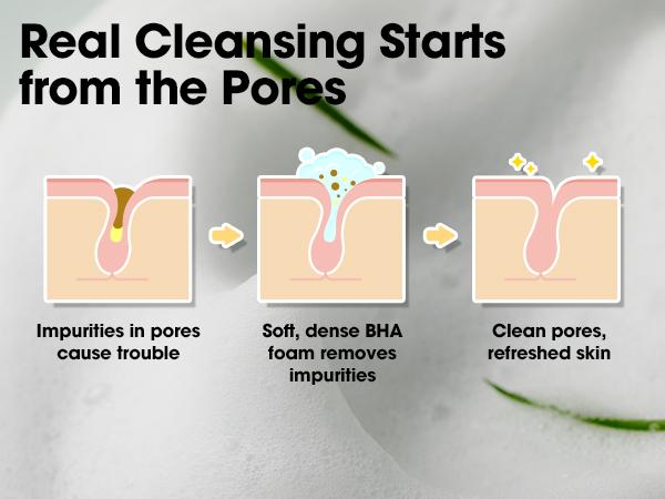 [SOME BY MI] Miracle Acne Cleansing Set – Deep Pore & Sebum Care for Face and Body Breakouts – Korean Skin Care