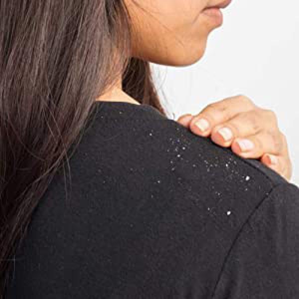 Scalp Massager, Shampoo Brush Hair Scrub Brush for Wet and Dry Hair, Soft Silicone Bristles Head Massager Clean Hair, Reduce Dandruff, Massage Scalp, Promote Hair Growth