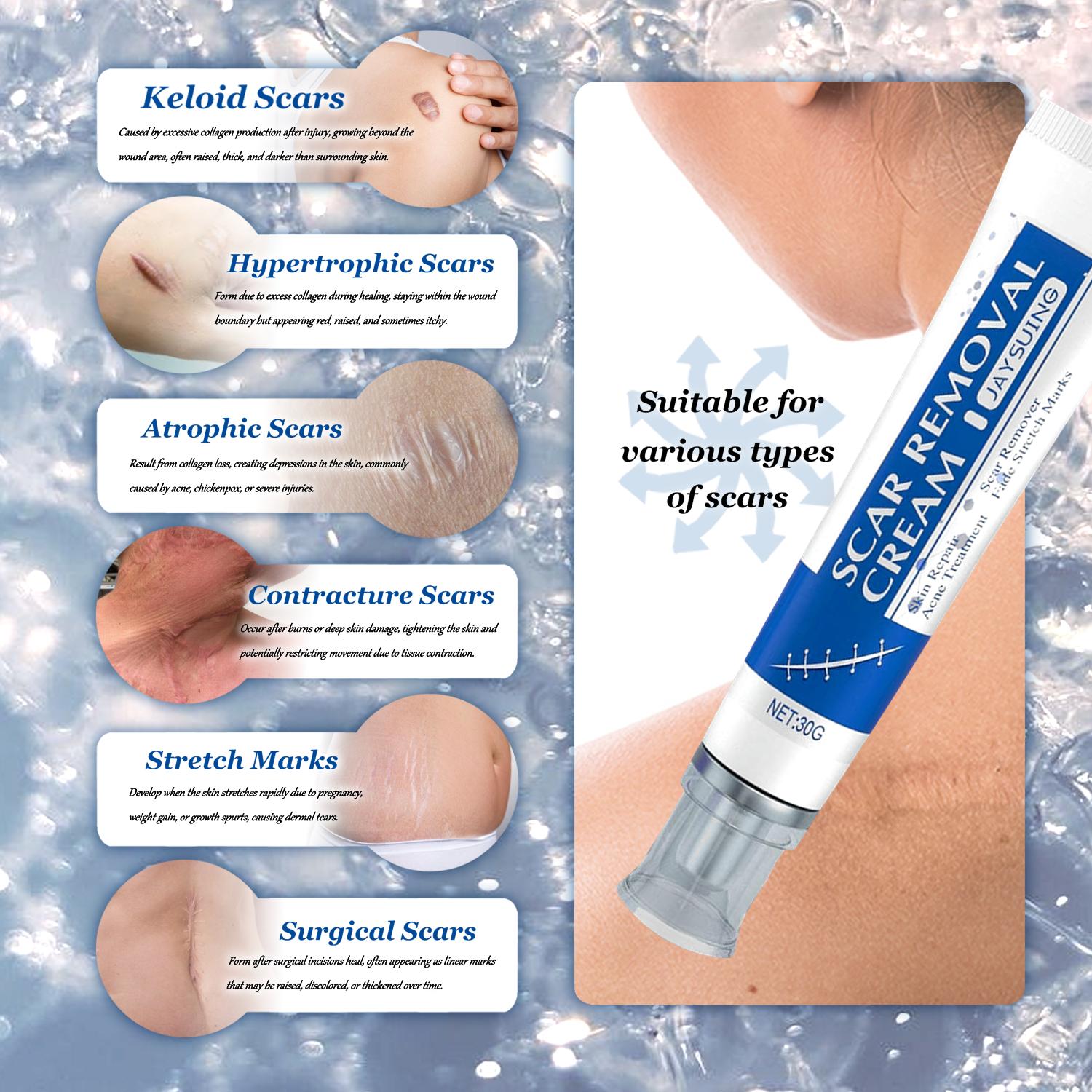 3 Repair Scar Smoothing Creams, Advanced Silicone Scar Removal Gel, Face & Body | Fades Dark Scars