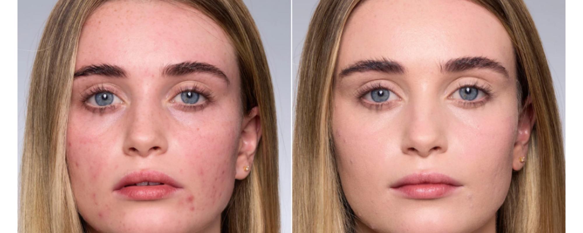 Forget The Filler Skin-Plumping Line-Smoothing Foundation