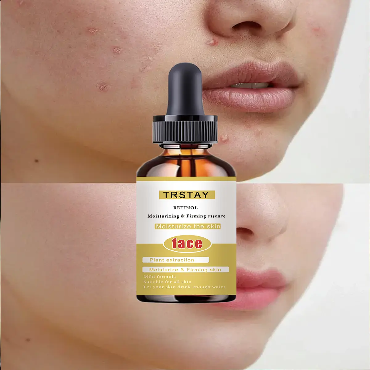 Facial Moisturizing Serum with Retinol, Hyaluronic Acid, Botanicals - 50ml Refreshing Non-Greasy Skincare Essence for Daily Face Hydration, Leaves Skin Smooth and Soft