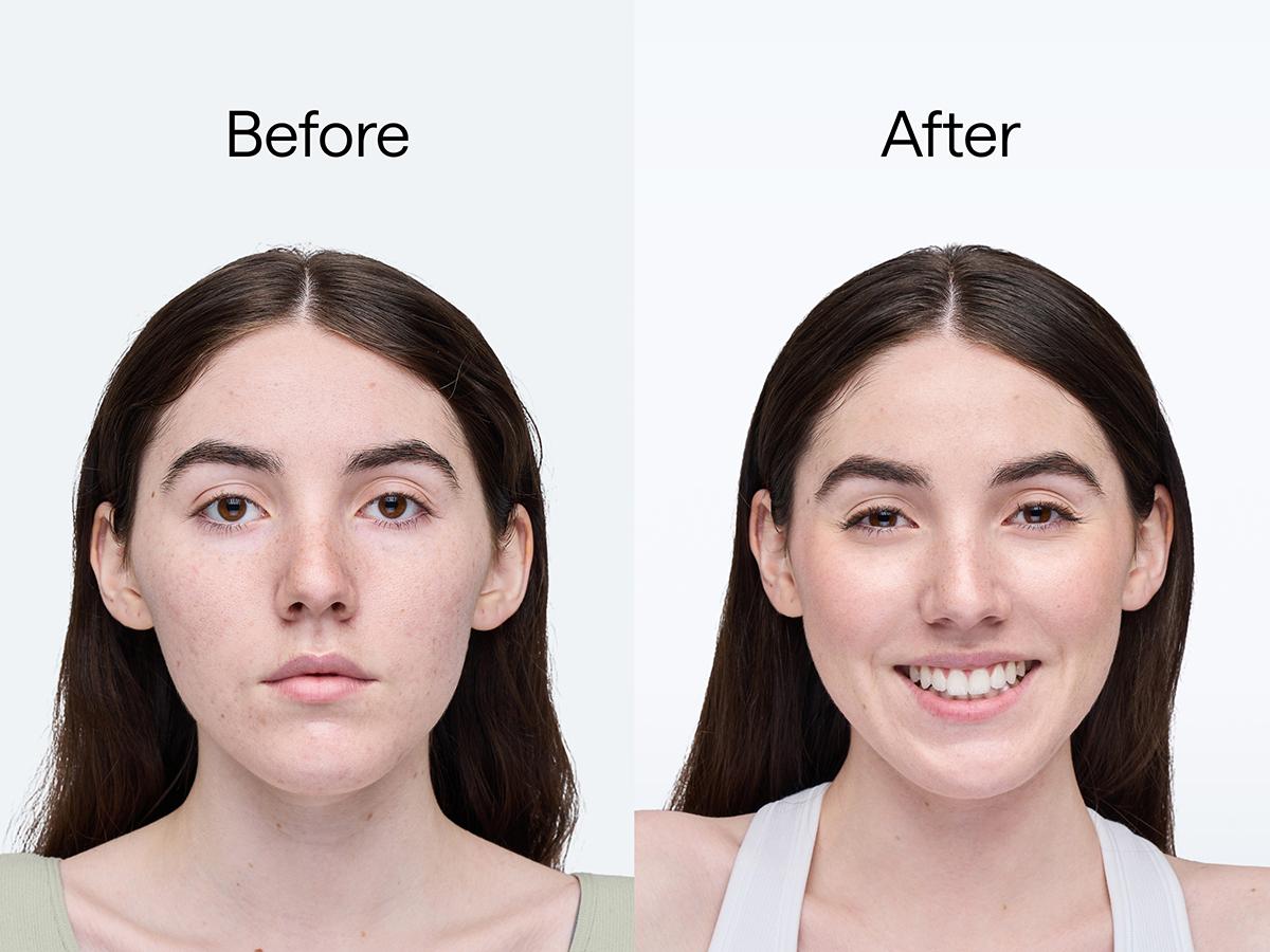 Ulike Water Molecule Hydrating Mask (5 pieces/box)