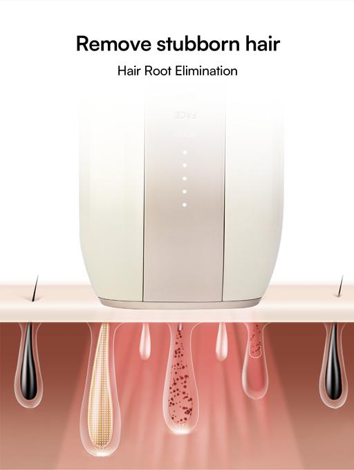 INIA FOND IPL At-Home Laser Hair Removal Device, Hair Root Elimination, 16.5J Energy, Unlimited Flashes, FDA Cleared, 2-Year Warranty, for Women and Men,Best Valentine's Day Gift for Her