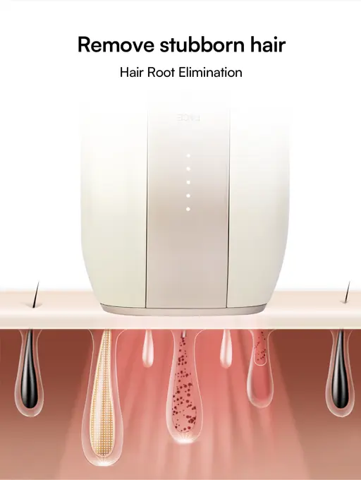 Product Introduction of INIA FOND IPL At-Home Laser Hair Removal Device, Hair Root Elimination, 16.5J Energy, Unlimited Flashes, FDA Cleared, 2-Year Warranty, for Women and Men,Best Valentine's Day Gift for Her 2