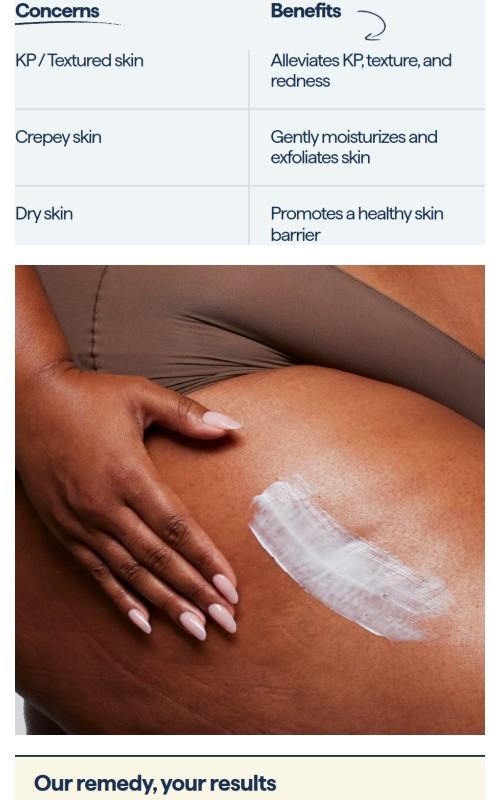 REMEDY for Body Bumps - KP Exfoliating Body Moisturizer