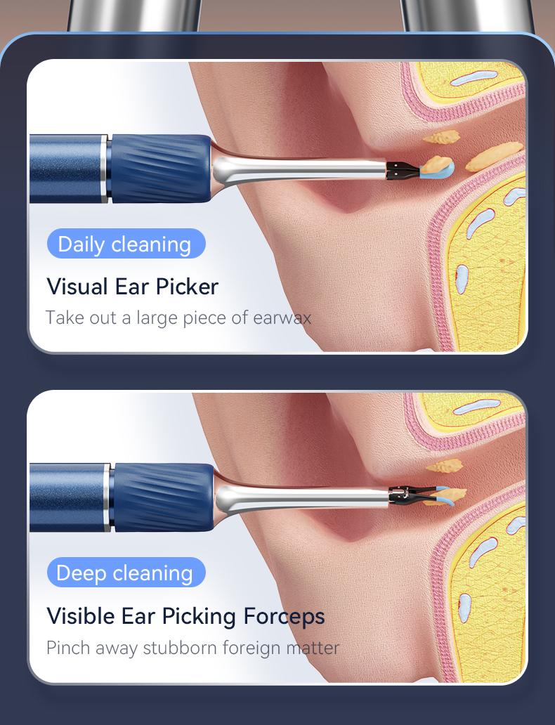 Ear Wax Removal Kit with Camera and Tools - Otoscope Ear Cleaner with Flexible HD Scope, Visual Ear Pick Tweezers Wax Remover, Safe Cleaning for Adults Kids
