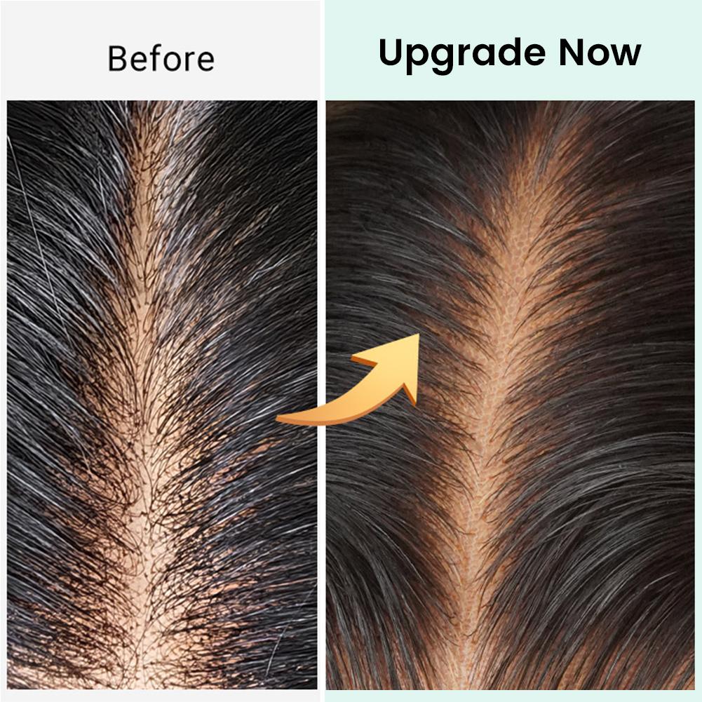 [Spring Must Have] Asteria Hair Straight Layered Glueless Wigs 5x5 Lace Closure Wig - Ready To Go,Beginner Friendly, Invisible Lace, Human Hair DealsForYouDays