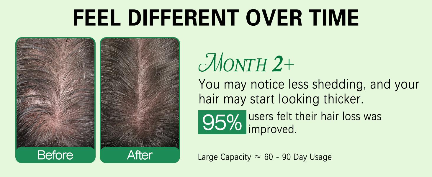 Rice Water Rosemary Spray - Rosemary & Rice Water Spray For Women & Men, Dry, Weak Hair, Thickening Haircare Organic