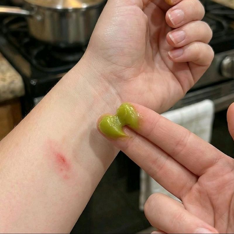 comfrey salve: broken bones, sprains, eczema, burns and bug bites Wellness Healing Therapeutic Leaf Lavender Therapy Solution Natural