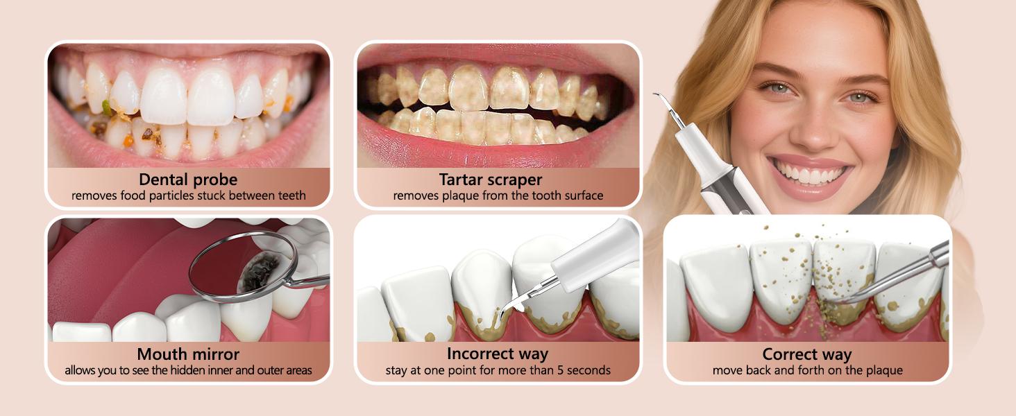 VOYOGA Plaque Remover for Teeth, Ultrasonic Dental Scaler,Electric Tooth Cleaner Tartar Remover for Teeth with LED Light,4 Modes Rechargeable Teeth Cleaning Kit with Dental Tools,