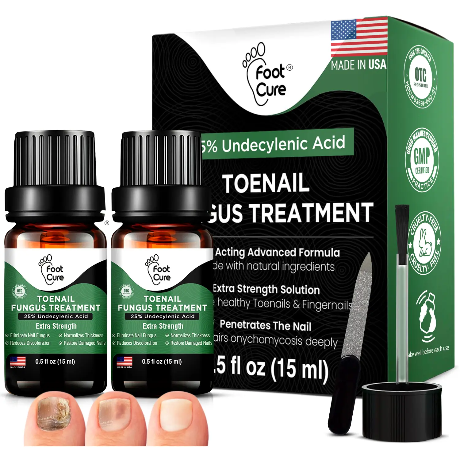 Foot Cure Extra Strength Toenail Fungus Treatment – 25% Undecylenic Acid Antifungal Nail Repair for Yellow, Thick & Ingrown Nails – Softens Damaged Nails on Fingers & Toes – 15ml