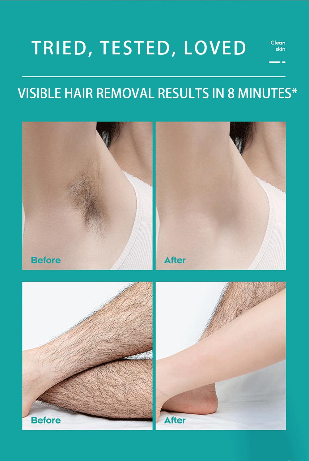 Umex Pain-Free Hair Removal Cream for Sensitive Skin, Hypoallergenic Formula – Gentle & Fast-Acting Depilatory Cream with Light Fresh Scent, Aloe Vera for Soothing Care, Suitable for Men & Women