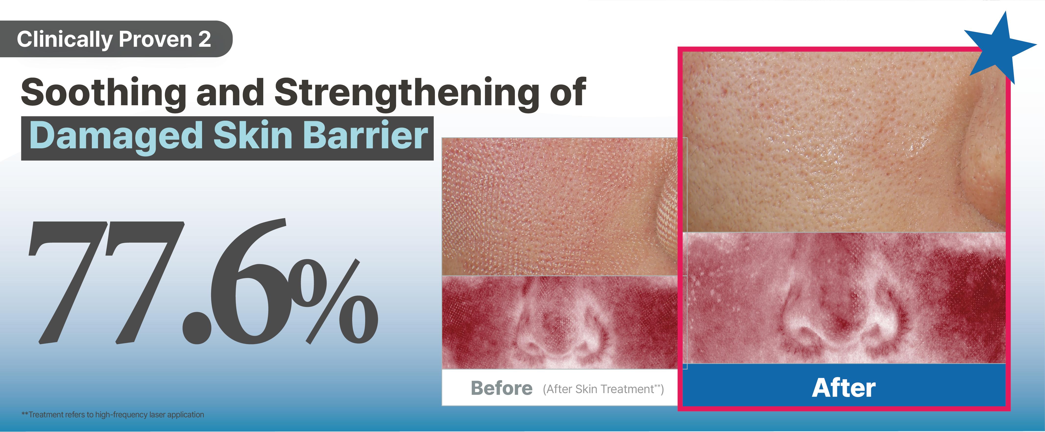 ILLIYOON Ceramide Ato Concentrate Gel Mask | Overnight Facial Mask for Glass Skin Glow, Collagen & Soy-Ceramide with Hyaluronic Acid, Korean Pore Tightening, Hypoallergenic, Vegan Certified, 1.19 oz X 4ea