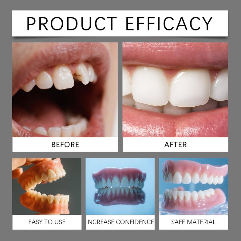 Temporary Dental Cosmetic Veneer Kit Comfortable Tooth Appearance Cover Smile Enhancement Teeth Beauty Kit