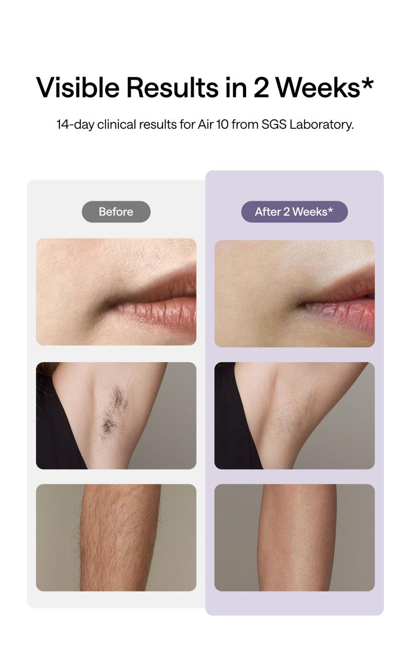 Ulike Laser Hair Removal, Air 10 IPL Hair Removal Device with Ice Cooling Comfort, Dual Lights, Skin Sensor & SHR Mode for Women & Men, Long-Lasting & Salon-liked Hair Removal Nearly Painless Result at Home, Christmas Present