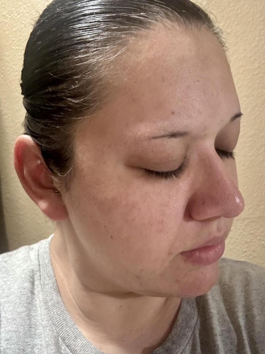 Item: Peel Shot Duo Set(white rice+ black rice)