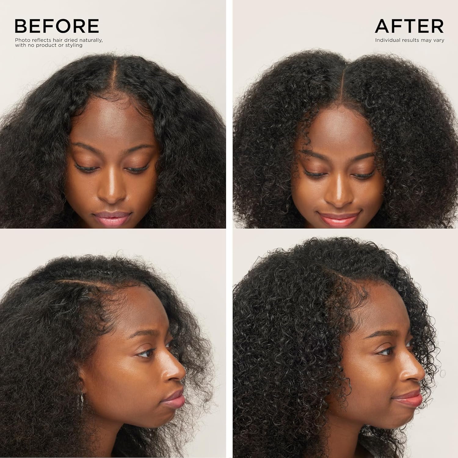 Dr. Groot Complete Set to Reduce Hair Loss, Scalp Revitalizing Solution, Hair Thickening, Biotin