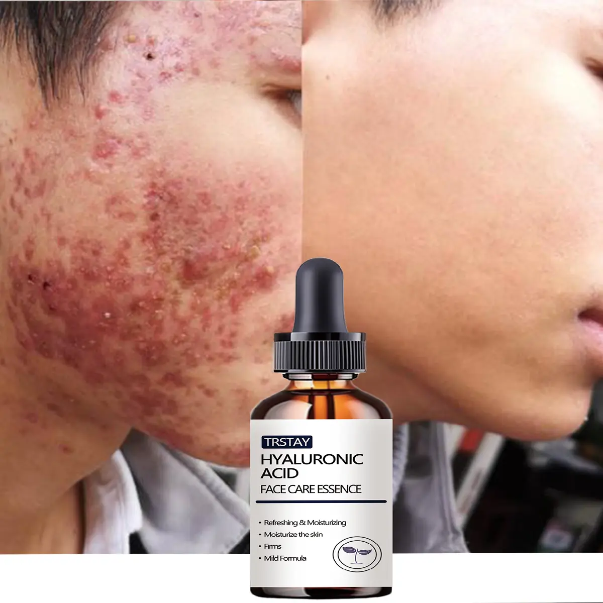Men's Hydrating Face Serum - Hyaluronic Acid Enriched Moisturizer for Dry Skin, Daily Face Care Products to Hydrate, Leaves Skin Smooth & Refreshed Without Greasy Residue