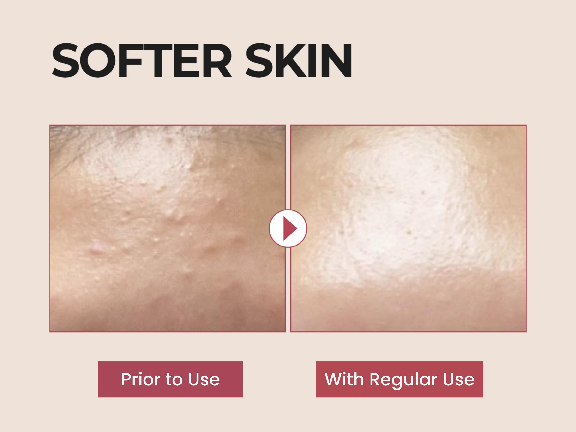 [numbuzin official shop] No.3 Serum | Skin Softening Serum | Pores, Textured, Bumpy, Rough to Glass Skin | Bifida, Galactomyces, Niacinamide, Adenosine, Panthenol | 1.69 fl. oz.