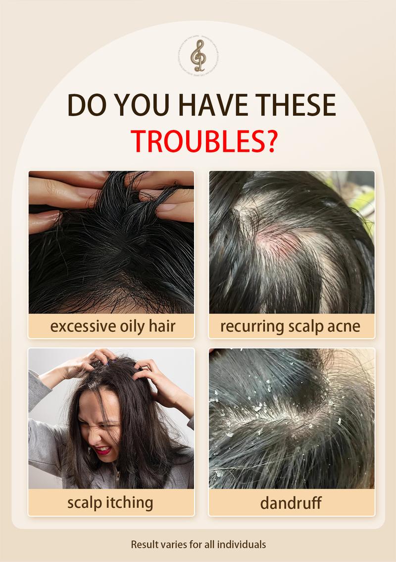 Buy 1 Get 1 Free! Tgideas All-in-One Sulfur Shampoo 250ml - Refresh Scalp, Gentle Formula, Organic Ingredients, Reduce Flakiness, Deep Cleansing for Men & Women Cleanser Scent