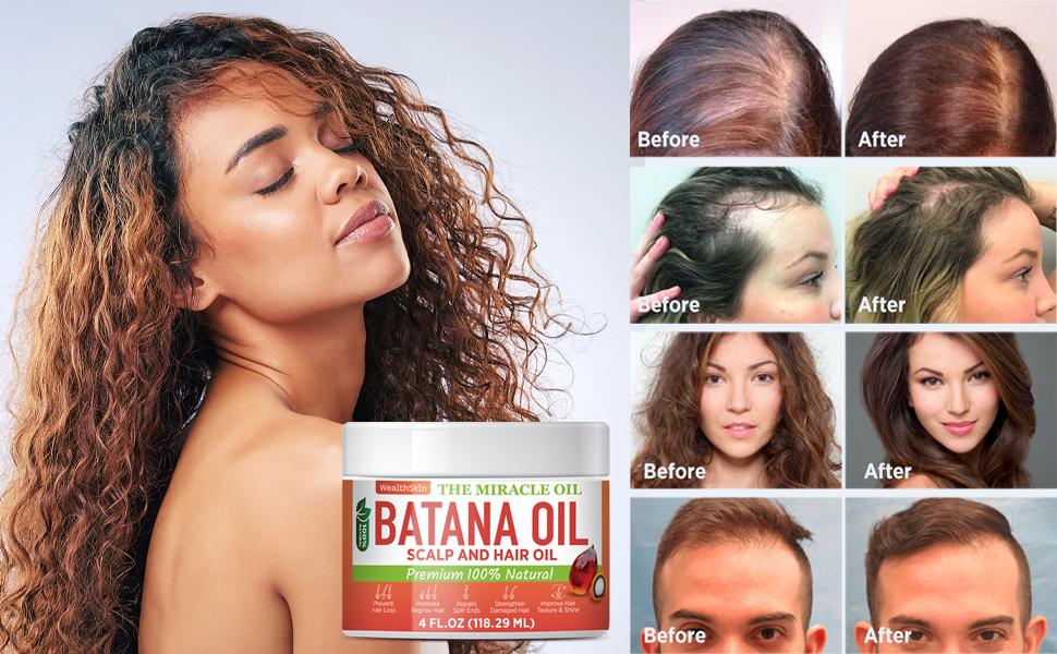Batana Oil From Honduras Repairs Damaged Hair, Dr. Sebi Reduces Hair Loss, And Nourishes Scalp. 100% Pure, Ideal As Hair Mask Or Scalp Oil, 4oz Batana Oil From Honduras Repairs Damaged Hair, Dr. Sebi Reduces Hair Loss, And Nourishes Scalp. 100% Pure, Ideal As Hair Mask Or Scalp Oil, 4oz