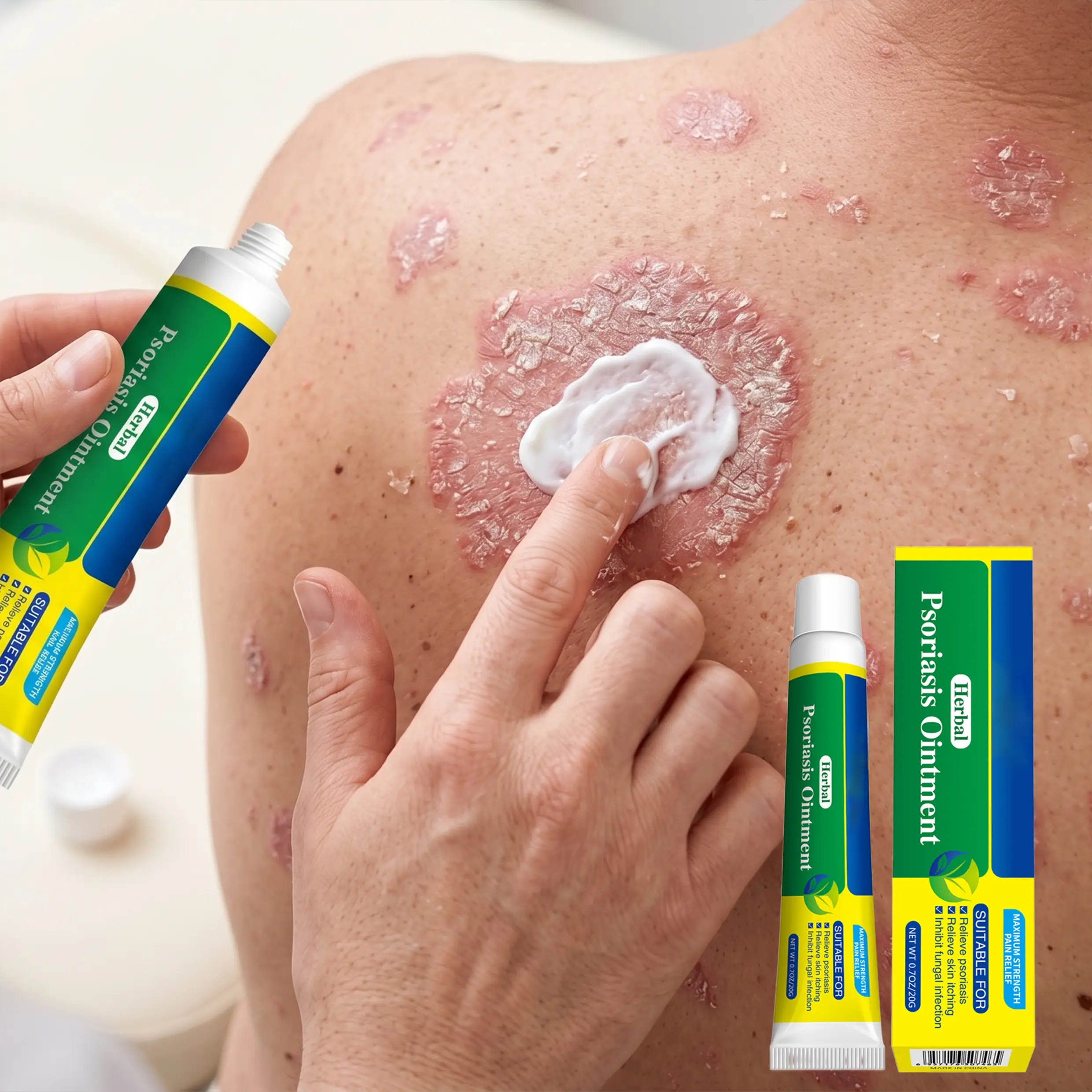 7-Day Sensitive Skin Relief Body Cream Moisturizer - Smooth, Fragrance-Free, Harsh Chemical-Free Hydrating Daily Ointment - Itch Allergy Relief Lotions & Creams, Gentle Lightweight Herbal Formula, 20g Body Care for Psoriasis,Tinea, Eczema