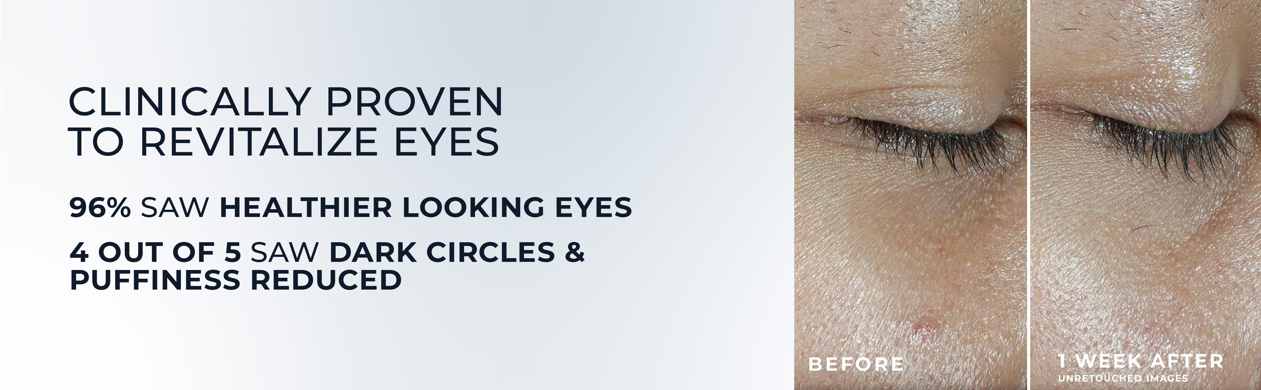 [RoC Skincare] MULTI CORREXION Revive + Glow Eye Balm