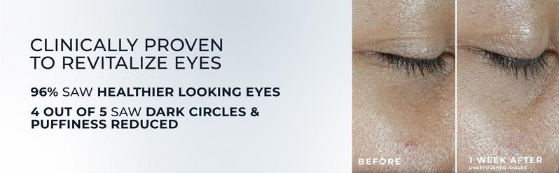 [RoC Skincare] MULTI CORREXION Revive + Glow Eye Balm