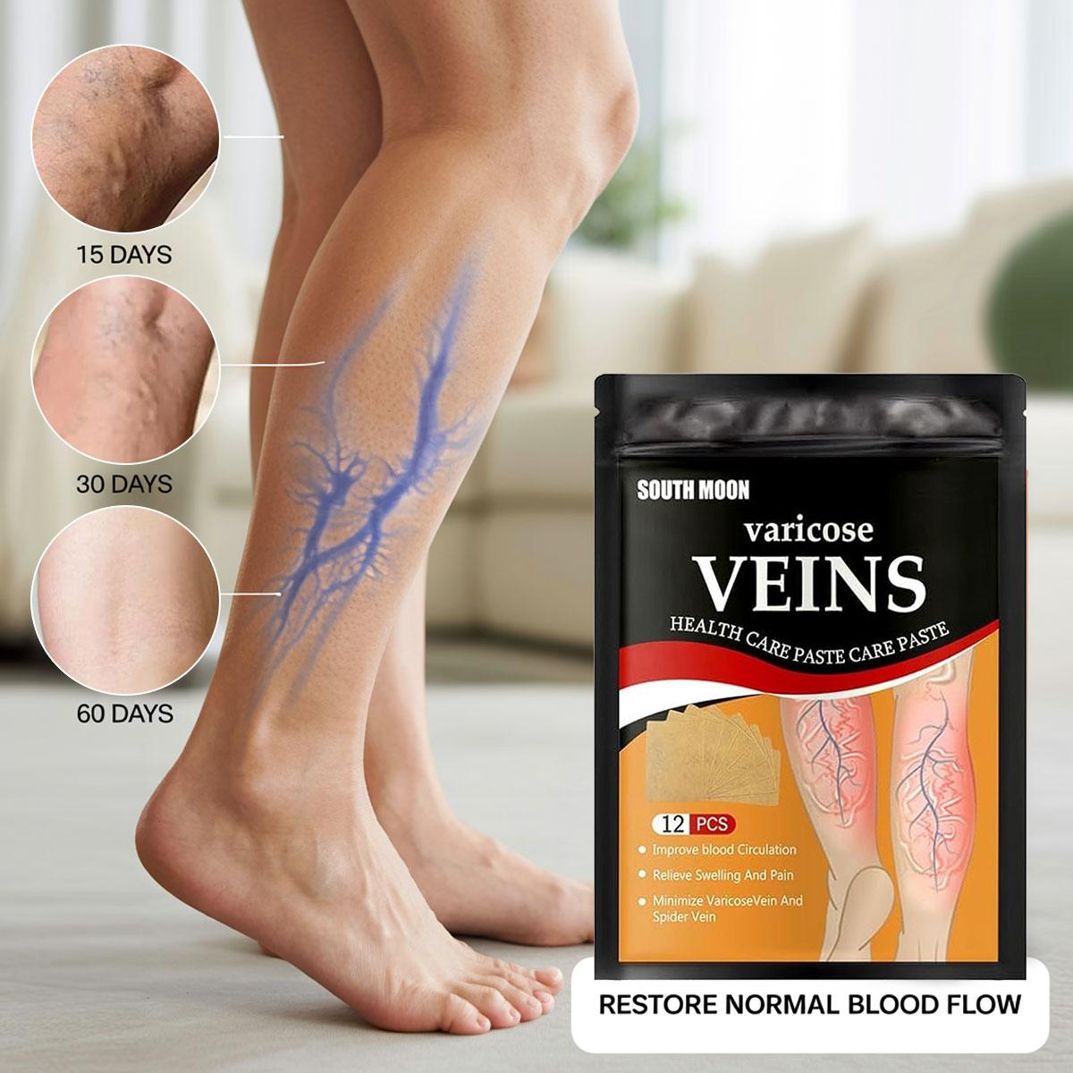 12pcs Herbal Varicose Vein Cold Compress Patches, 24 Months Shelf Life, Natural Venous Health Support, Leg Pain Relief for Leg Care