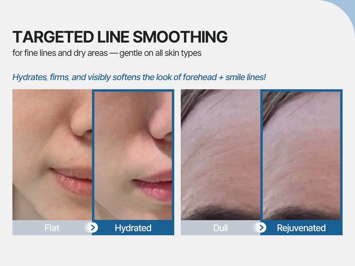 Collagen Hydrogel Facial Patch - Forehead and Smile Line Wrinkle Patches - Anti Wrinkle Patches for Lip - Face Tape Overnight Self Care for Woman for Smoothing and Firming - Smile Line Patches - Honeydew Labs (6 Pack) Collagen Hydrogel Facial Patch - Forehead and Smile Line Wrinkle Patches - Anti Wrinkle Patches for Lip - Face Tape Overnight Self Care for Woman for Smoothing and Firming - Smile Line Patches - Honeydew Labs (6 Pack)