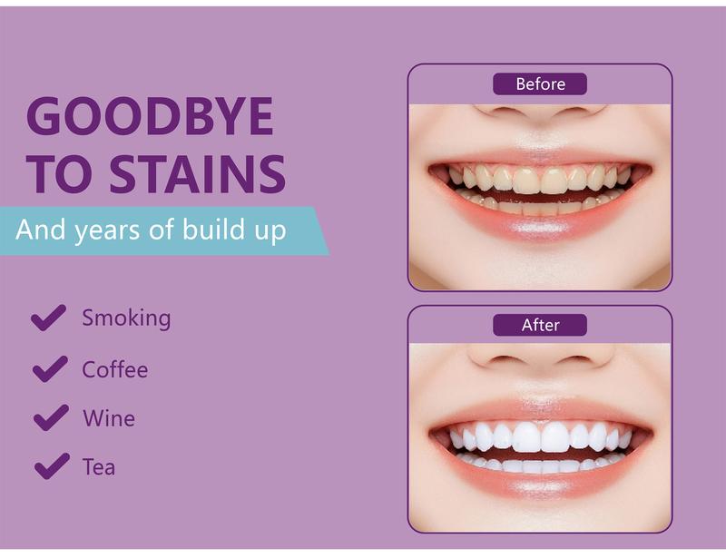 Purple Whitening Strips by Oralhoe 2026 - 7 to 21 Days Fast Results, Peroxide-Free & Enamel-Safe for Sensitive Teeth