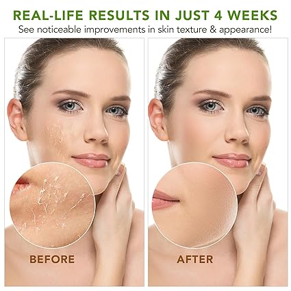 Shea Butter, Shea Butter Raw Organic, Soothes, Nourishes and Softens Dry Skin, Raw & Undefined Shea Butter Suitable for All Skin Types-7.8 oz