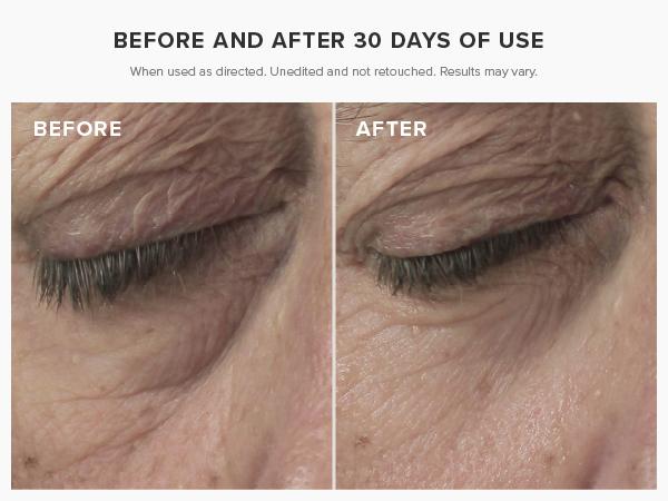 DRMTLGY Brightening Eye Masks (60 ct) with Peptides, Caffeine, and Hyaluronic Acid Lightweight Moisture