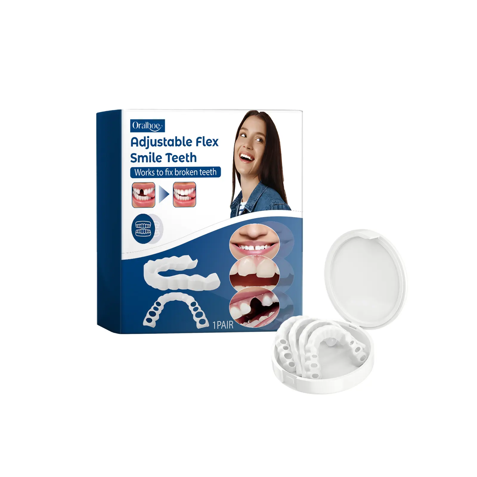 Oralhoe Adjustable Snap‑on Veneers, Realistic Fake Teeth, Temporary Cosmetic Dental Kit for Smile Makeover